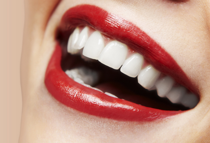 teeth whitening image